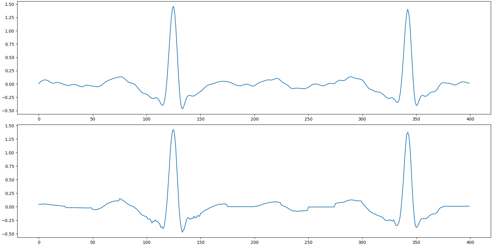 ecg cs bsbl